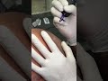 Scalp Micro Pro Clinic performing SMP on a 5 year Touch up