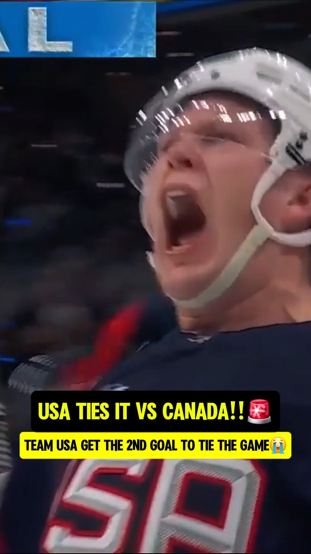 Tkachuk makes it 1-1 for Team USA?