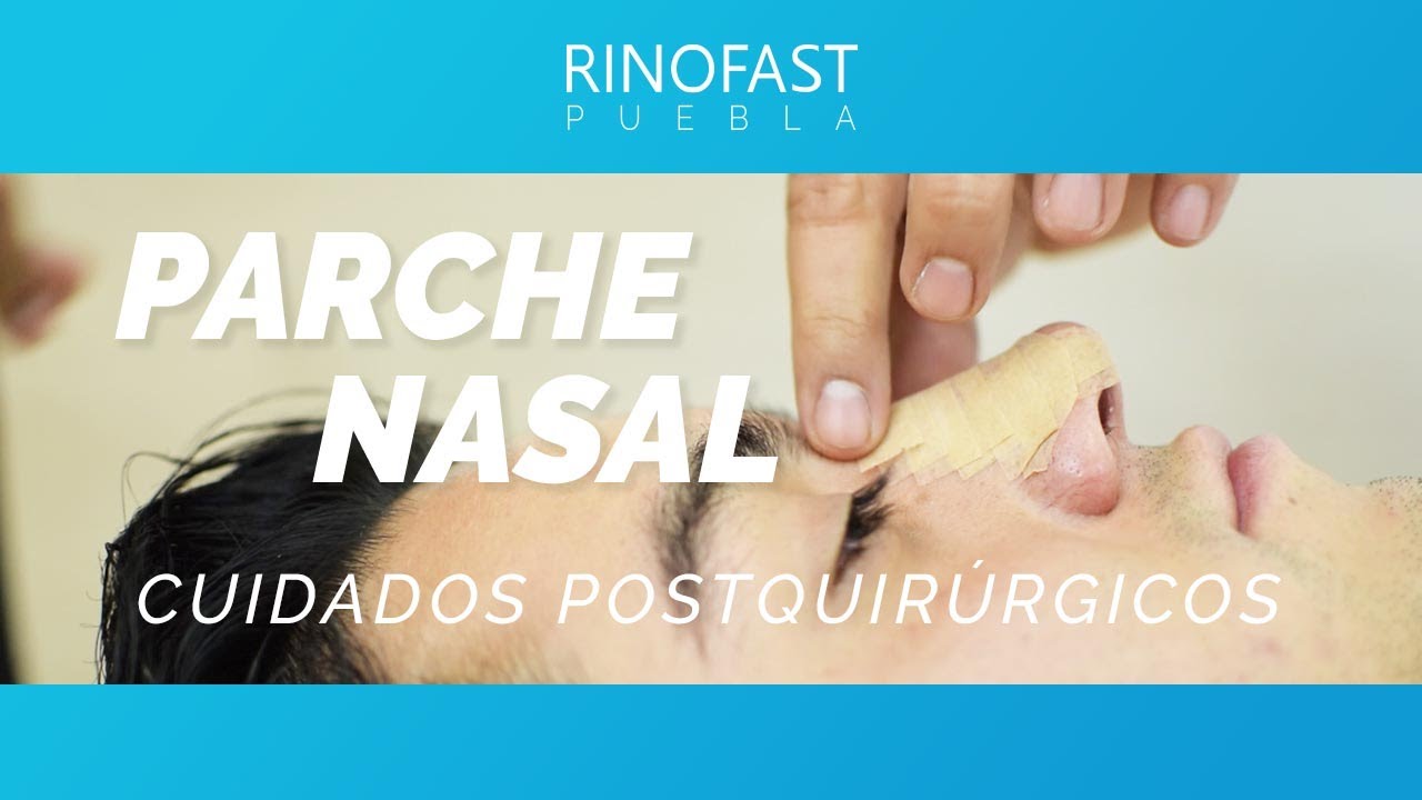 Parche nasal Rinofast Puebla