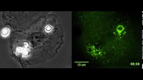 Macrophage oxidative burst