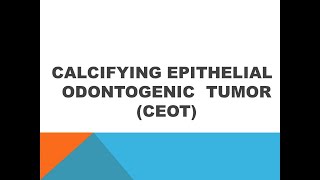 Calcifying Epithelial Odontogenic Tumor Ceotppt