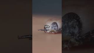 Famous Shocking things found in ears !                                            #facts #didyouknow #scary Net Worth