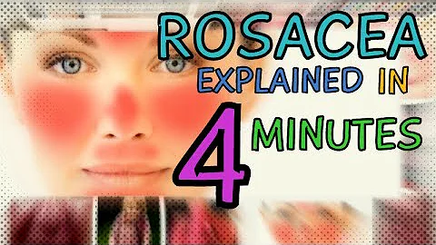 What causes acne rosacea?