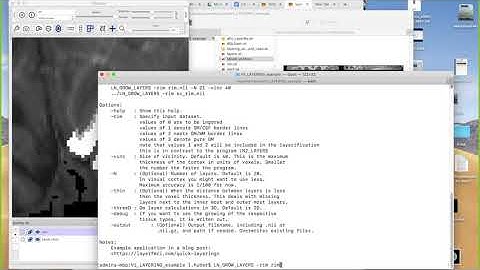 Renzo Huber: Hands on layering with LAYNII