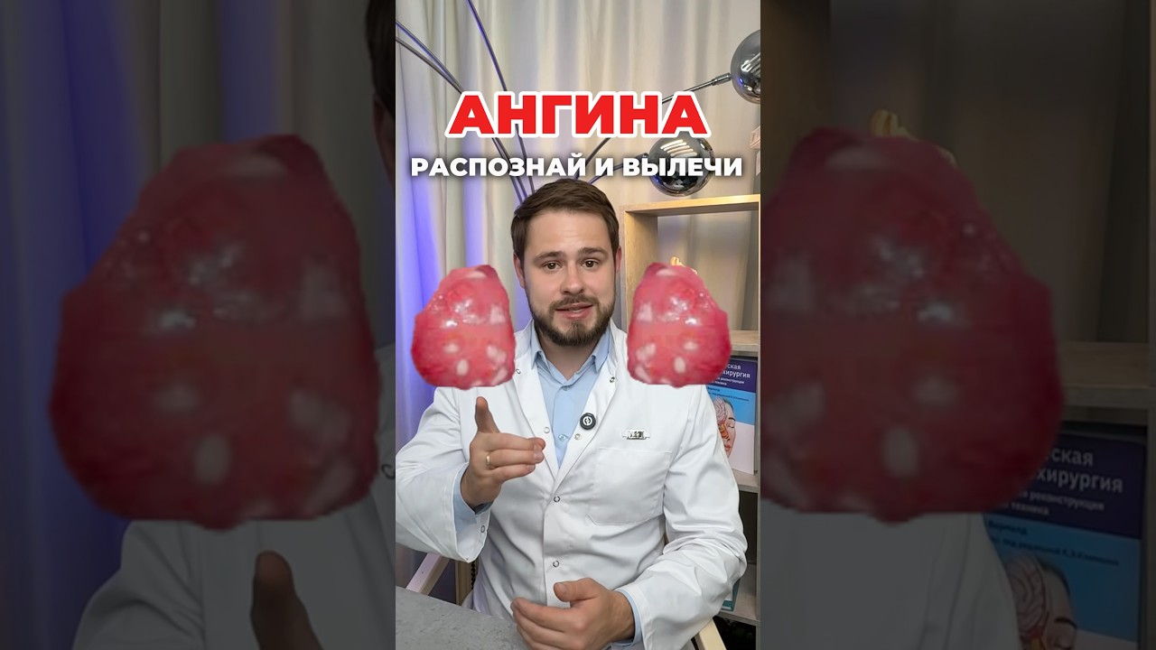 АНГИНА? РАСПОЗНАЙ И ВЫЛЕЧИ! #лор #ангина #тонзиллит