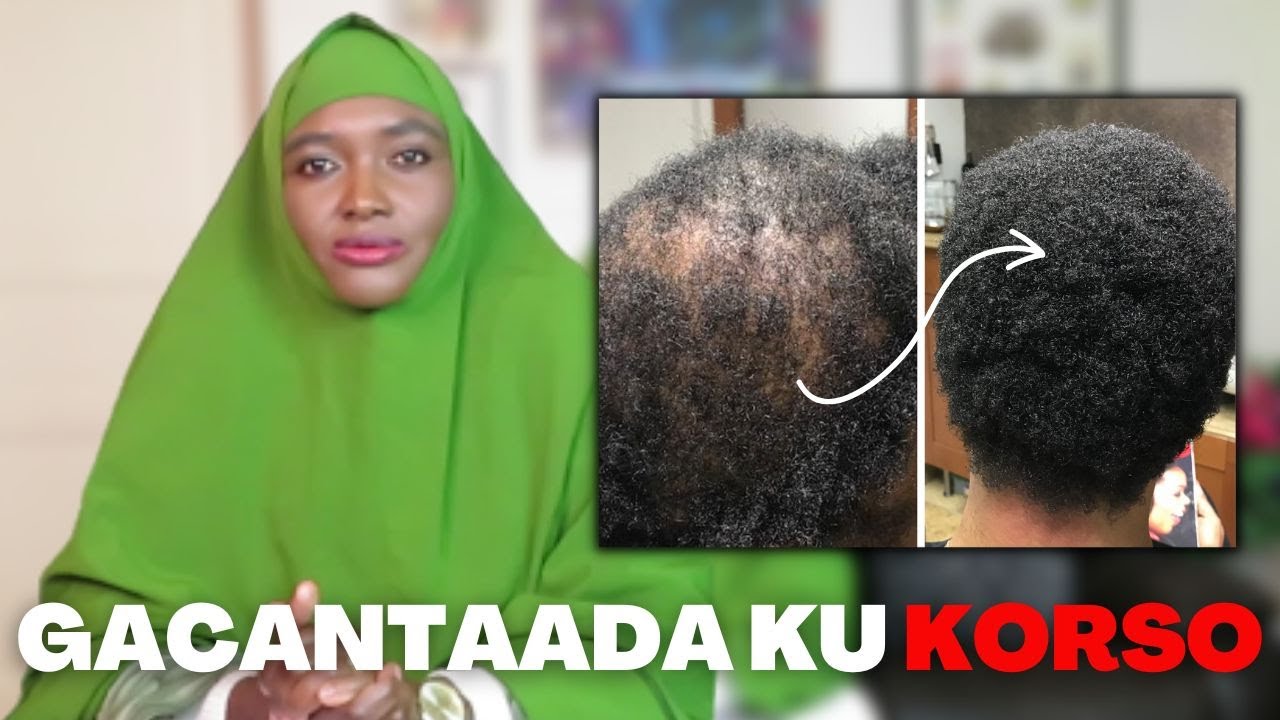 NAFAQADA AY TIMAHA KU BAXAAN?! / PART 1