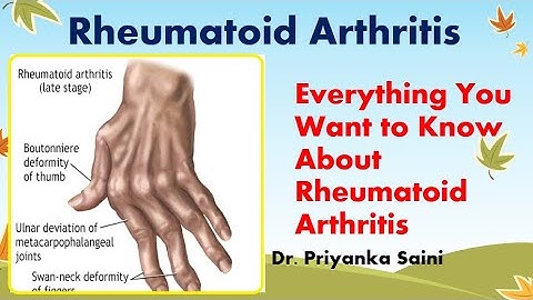 Everything You Want to Know About Rheumatoid Arthritis|INVESTIGATION | MANAGEMENT~Dr. Priyanka Saini