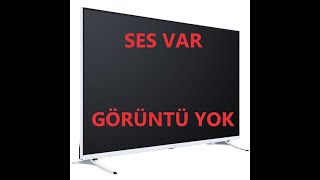 Televizyonda Ses Var Görüntü Yok