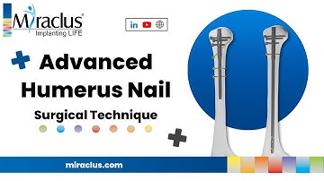 Advanced Humerus Nail | Indications, Features & Surgical Technique | Miraclus