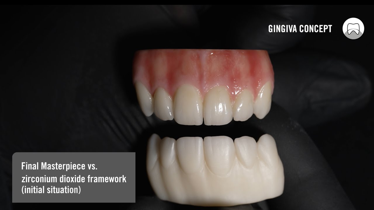 HeraCeram cre-active - Tutorial - Pink & White Aesthetic Finishing