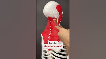 Painful Muscle Knots? These are TRIGGER POINTS— let’s release ‘em! #neckpain #jawpain #musclerelease