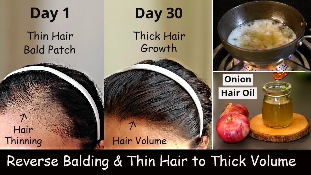 Thin Hair to Thick Hair & Increase Hair Volume - Fenugreek Onion Hair ...