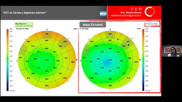 Curso OCT y OCT-A - Módulo 1