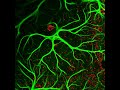 Understanding the role of octopamine in neurodegeneration