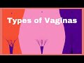 Types of Vaginas, shapes and sizes, Normal or abnormal?