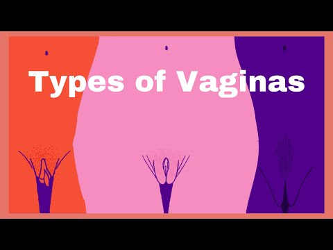 Types of Vaginas, shapes and sizes, Normal or abnormal?