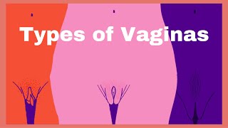 Types of Vaginas, shapes and sizes, Normal or abnormal?