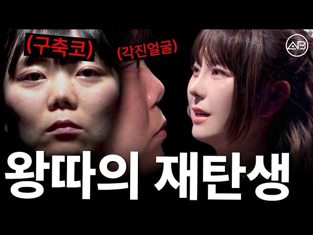 [MAKE ME Girl] 구축코로 고통받던 여자가 코재수술을 한 사연 | 맥미걸 | 에이비성형외과