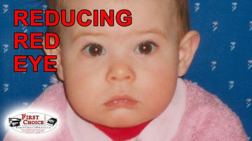 PROFESSIONAL TIPS to reduce Red Eye in your photos. Should you use Red Eye Reduction in camera?