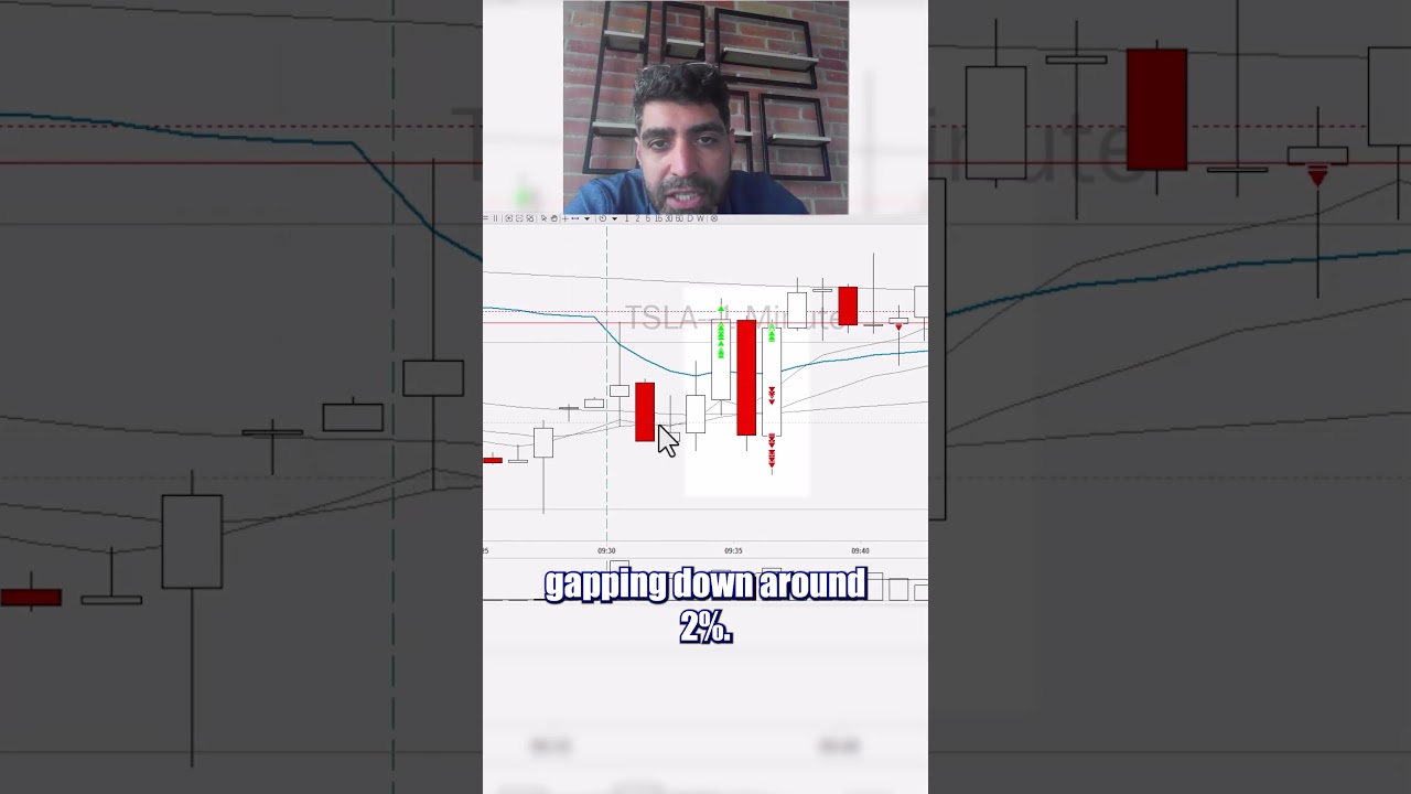 MASSIVE $20,000 Loss & How to Recover #trading #daytrading101 #stockmarket
