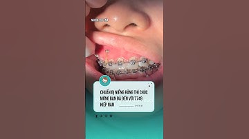 7749 kiếp nạn khi niềng răng  #nhakhoa #niengrang #nhatkyniengrang  #viral