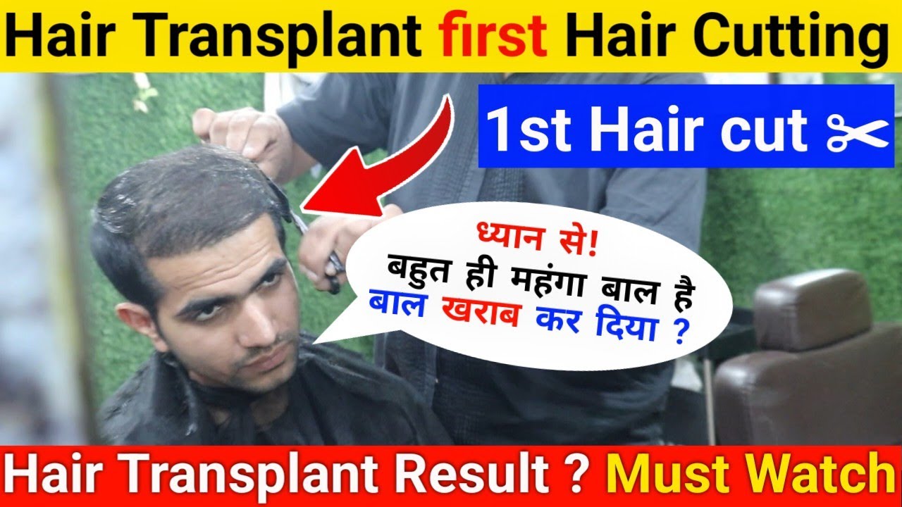 My First hair cut Hair transplant 1st hair cutting hair transplant ke