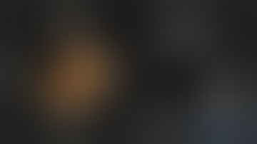 Robotic Subtotal Gastrectomy with D2 Lymphadenectomy for Gastric Cancer | Dr. Nikhil Agrawal