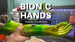 Bionic Arm Prosthetics - Motorica