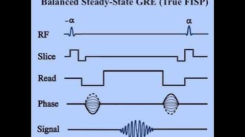 What is (True FISP) MRI sequence?