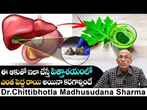 How to Melt Gallbladder Stones | పిత్తాశయంలోని రాళ్లను ఎలా కరిగించాలి.? | Dr. C Madhusudhana Sharma