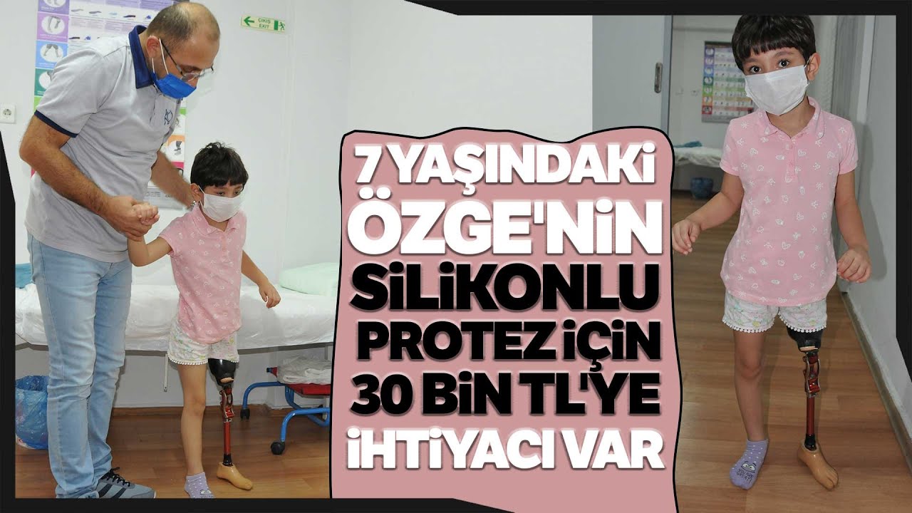Bacağı Kesilen Özge’ye Silikonlu Protez İçin 30 Bin TL Gerekiyor