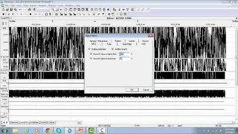 Remlogic Video 12  Signal Status final