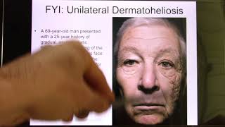 ACC Biol2401 API Online Lecture Ch5 Skin1