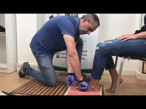 Come si prendono le misure dei piedi per la realizzazione del plantare ortopedico su misura