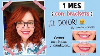 PRIMER MES CON BRACKETS... ¡EL DOLOR! 😭 CAMBIO DE LIGAS Y PROGRESO | MI EXPERIENCIA | Mirem Itziar ❤