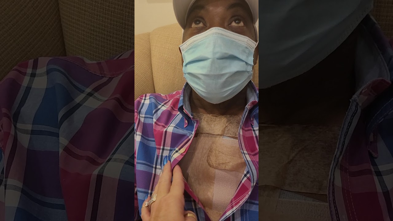 Dr. Sassani 1 week post op 9/14/2020