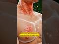 Egg Side Effects Explained (Allergy, Stomach Irritation, Bloating) #health3d #egg #facts