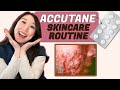 Simple accutane skincare routine  dr joyce dermatologist