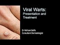 Viral Warts: Presentation and Treatment