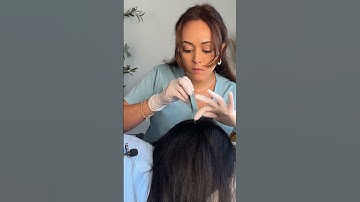 Satisfying Perfectionist Scalp Check using Interesting Tools 🤤 #asmr #asmrscalpcheck #asmrsatisfyin