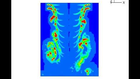 Coaxial rotor wake in hover