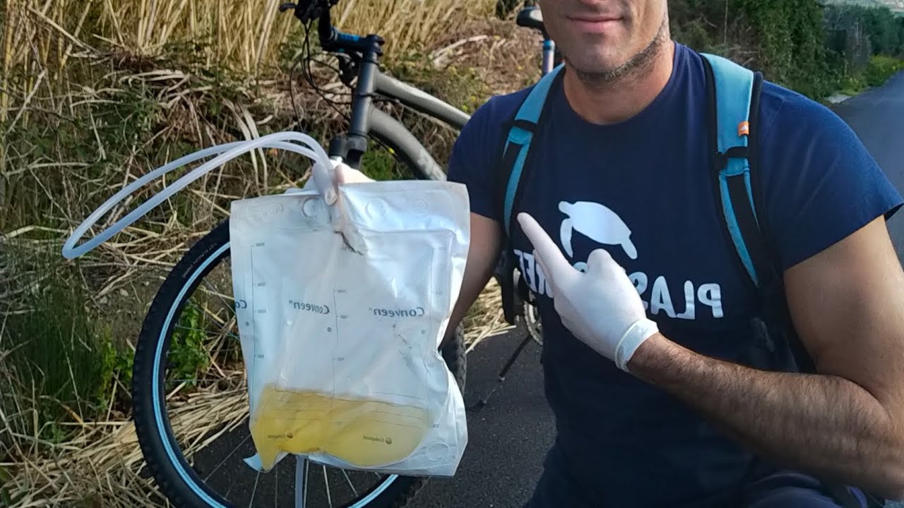 I CATETERI DI MONGIOVE