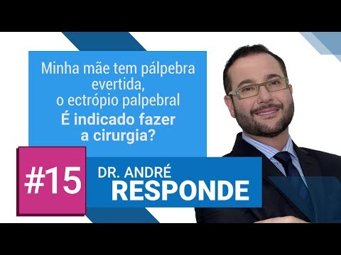 É indicado fazer