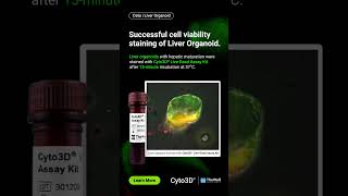 Successful cell viability staining of Liver Organoid | Cyto3D® Live-Dead Assay Kit