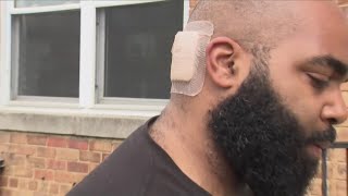 “This dude just came at me with a knife" | 6 Northeast DC stabbing victims in recovery