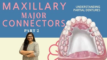 Maxillary Major Connectors | Removable Partial Denture (RPD) | Dr. Rashmi Singh