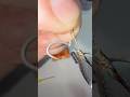 Whirlwind-Rig #carpfishing #fishing #рыбалка #carp #fish #hook #shortvideo #shorts