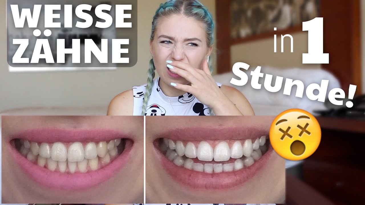 Strahlend Weisse Zahne In Nur 1 Stunde Kein Fake Bibisbeautypalace Youtube