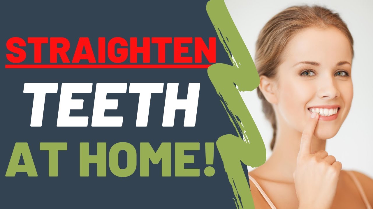 Straighten Your Teeth At Home Naturally | Dentist Updated (2021)