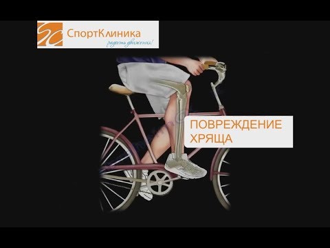 Строение хрящевой ткани. Остеоартроз